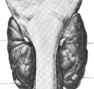 El ARBÍTRO libre y la elección de la píldora roja o azul