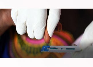 Uso de contraceptivo hormonal não aumenta risco de infecção por HIV, diz OMS